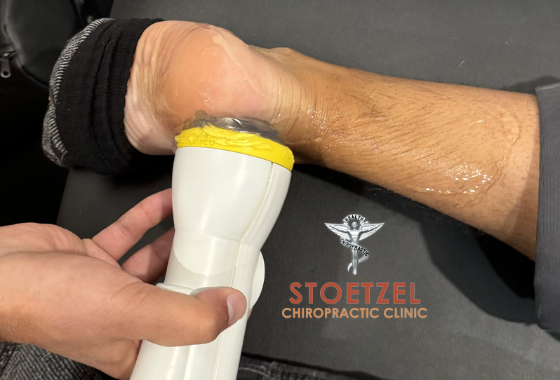Advanced Foot & Ankle Pain Relief in Winston-Salem with SoftWave Tissue Regeneration Technology at Stoetzel Chiropractic Clinic